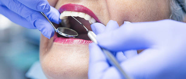 Best Emergency Dental Care for Broken or Chipped Teeth in , NH